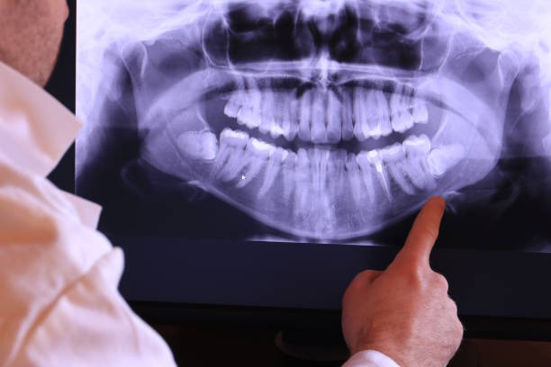 Best Walk-In Emergency Dentist in Mcclure, PA